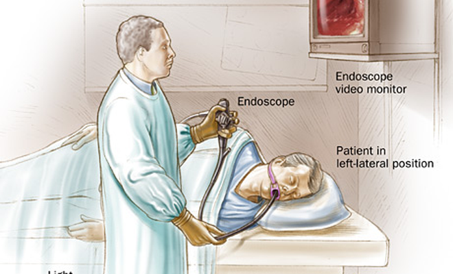 Endoskopi, Kolonoskopi veya  Ultrason orucu bozar mı?