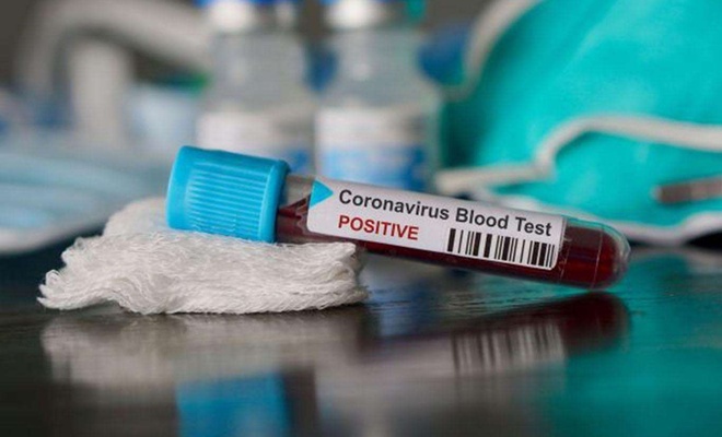 Fransa'da Coronavirus vaka sayıları artıyor