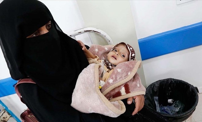 DSÖ: Yemenli çocukların yüzde 75'i yetersiz beslenmeden muzdarip