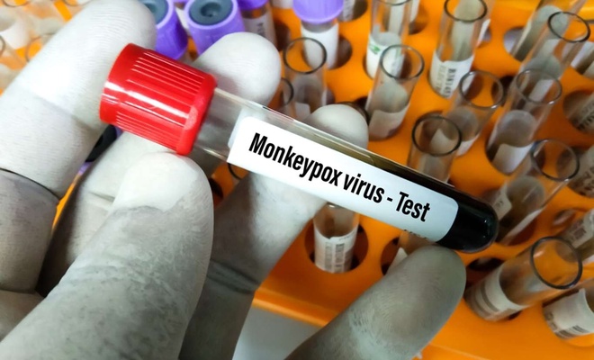 Report :  World Health Organization Plans to Rename Monkeypox to 'MPOX' to Destigmatize Virus.