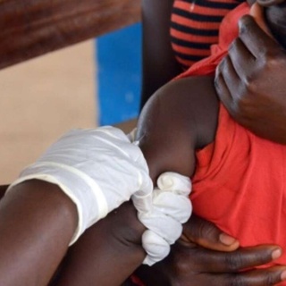 Zimbabve&#8217;de kızamık nedeniyle 698 çocuk hayatını kaybetti, Nusaybin Medya